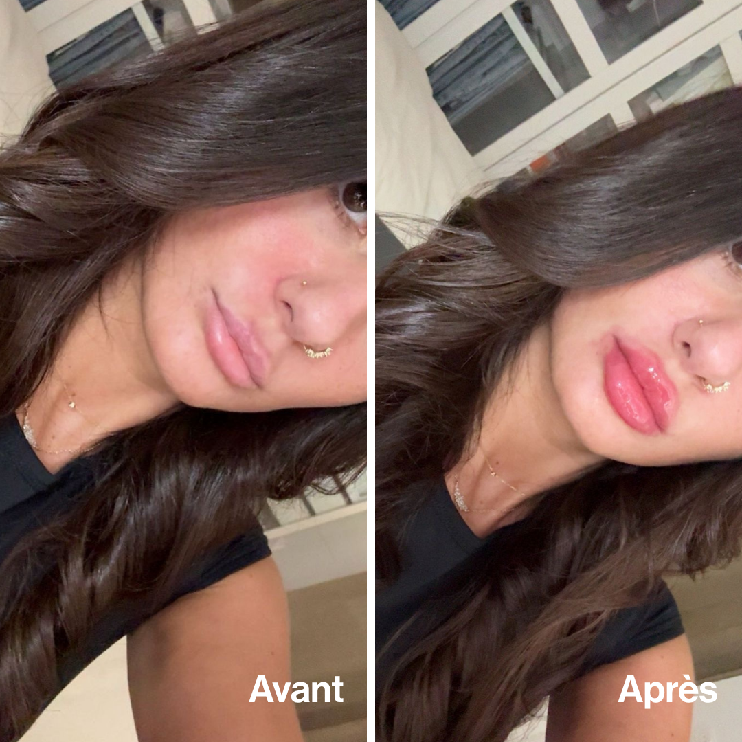 Lip Volume Extrême