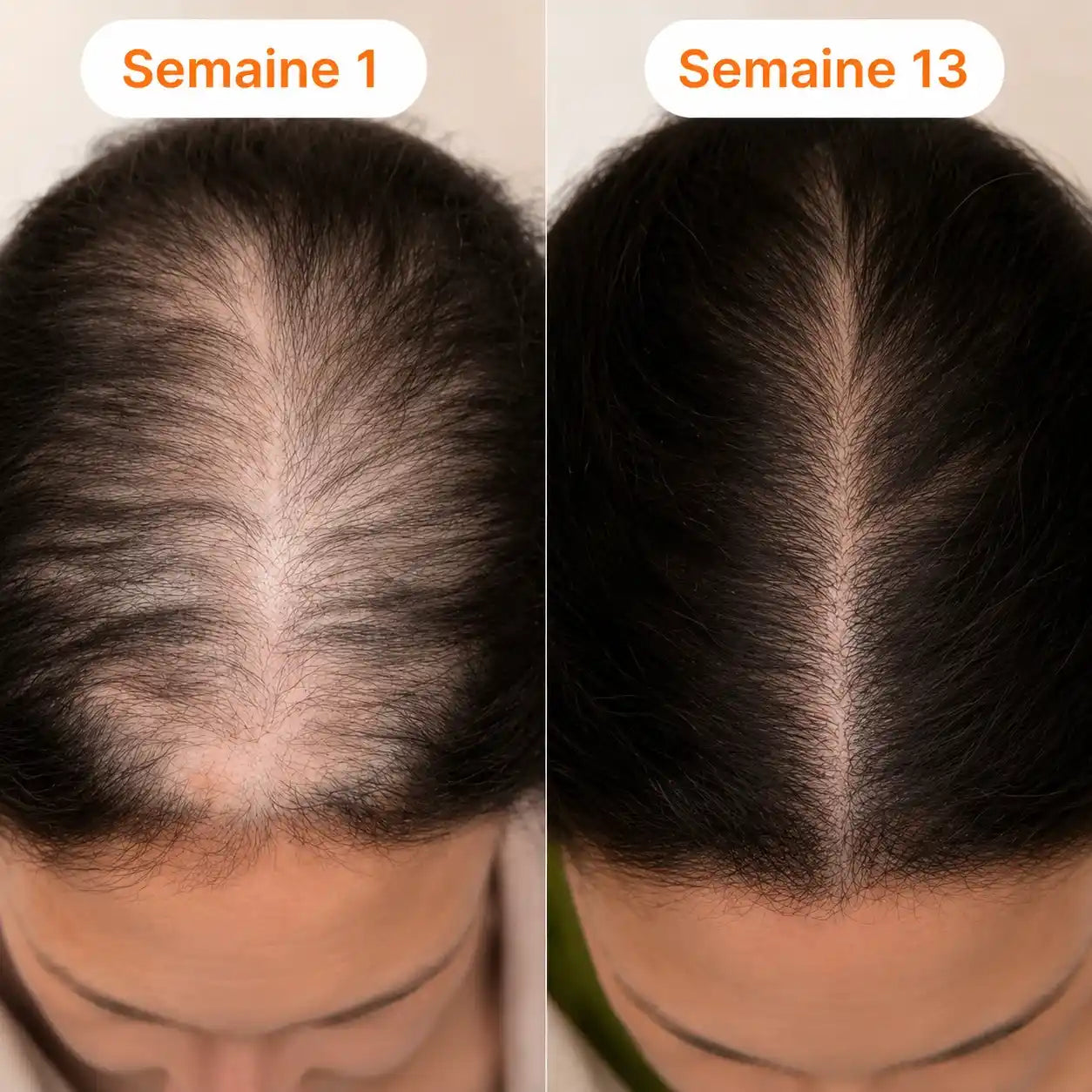 Sérum Capillaire Kavira Coréen N°1